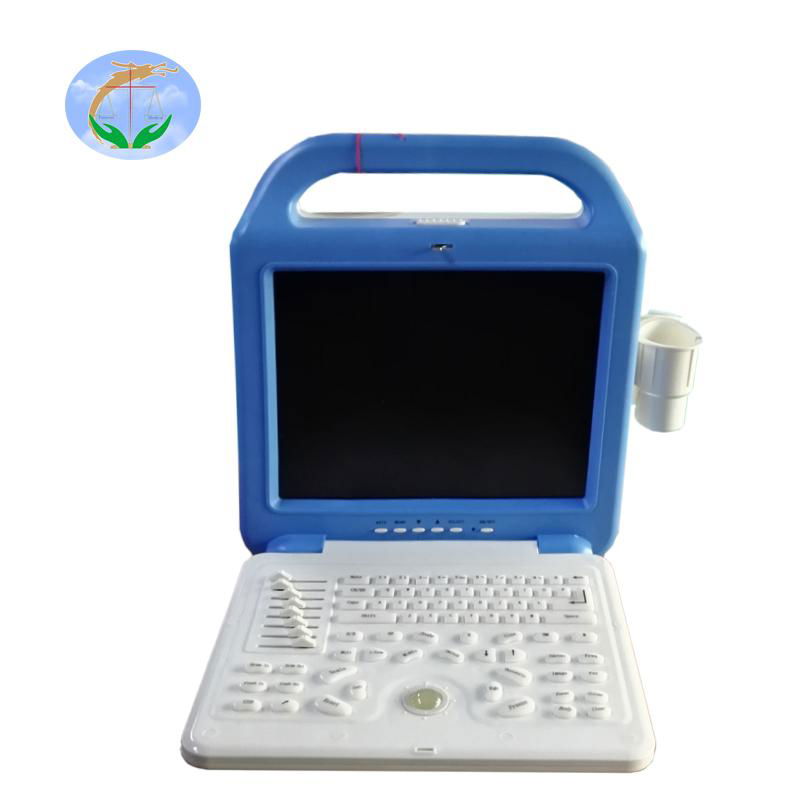 Digital ultrasound machine trolley ultrasonic diagnostic equipment  3