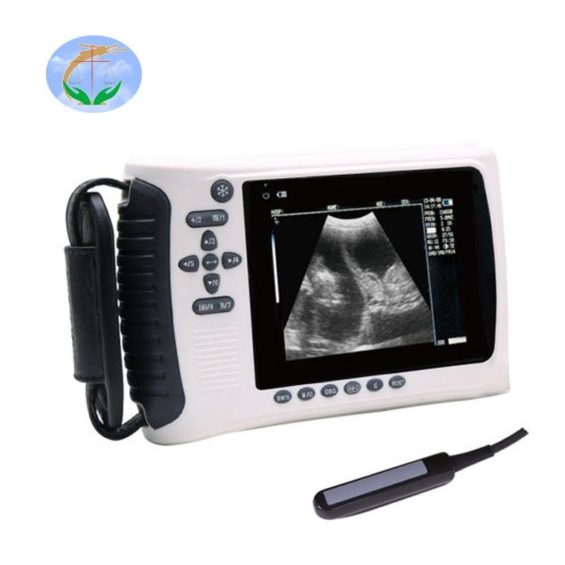 High quality color doppler ultrasound diagnosis system