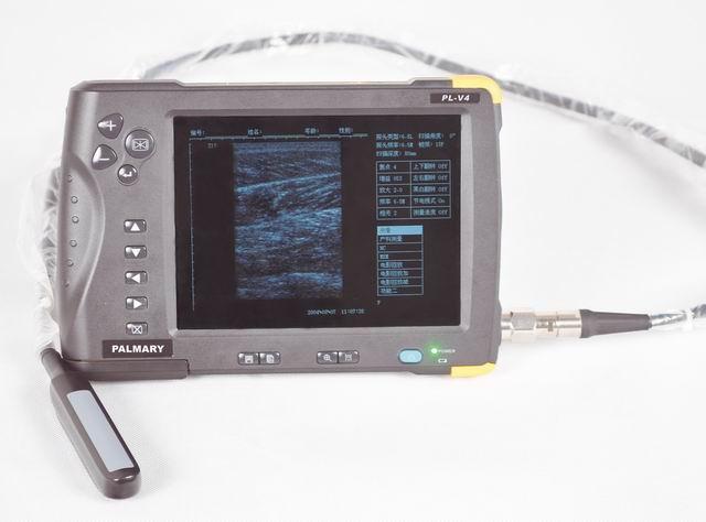 High quality color doppler ultrasound diagnosis system 3