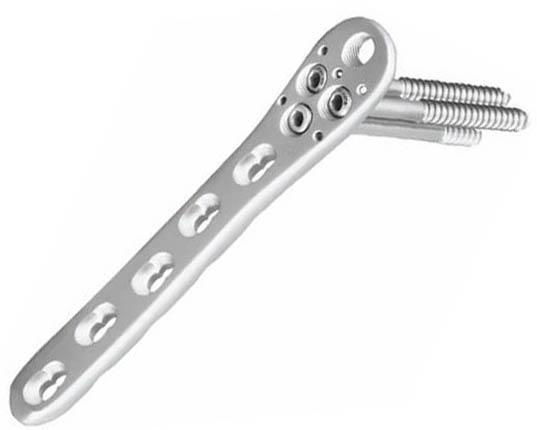 Proximal lateral femoral locking plate III-Placa para fémur proximal lateral