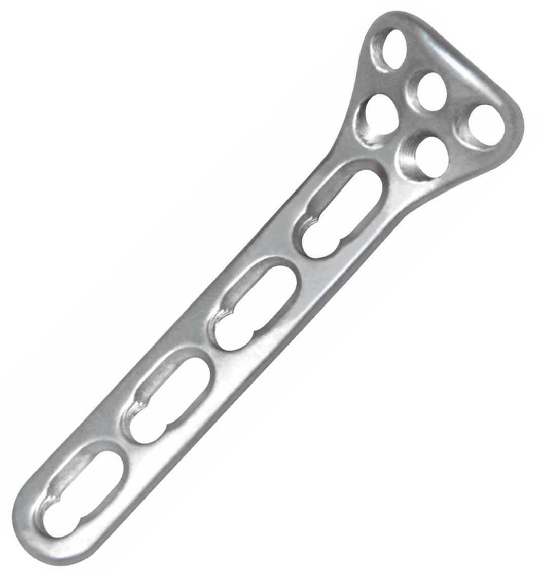 Proximal radius neck locking plate - Placa de bloqueo de cuello radial proximal