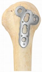 Humeral large nodule locking plate-Placa de bloqueo para nódulo grande húmero