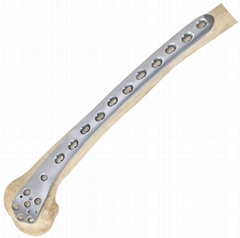 Distal Femoral lateral compression plate-Placa para Cóndilo fémur distal lateral