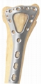 Distal radius dorsal triangular