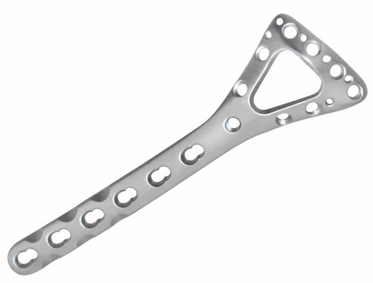 Distal radius dorsal triangular locking plate