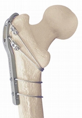 Periprosthetic proximal femoral hook plate I-Placa gancho para  fémur proximal