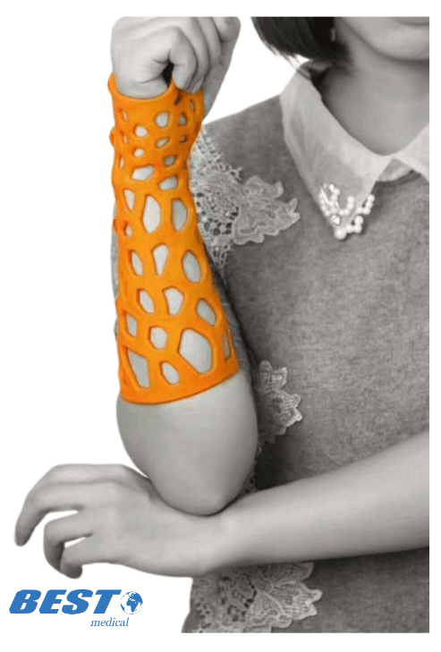 Thermoplastic Flexible Hand Elbow Ankle Splints 2