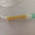 Sterilized Medical iv Infusion Giving Set With Needles 5