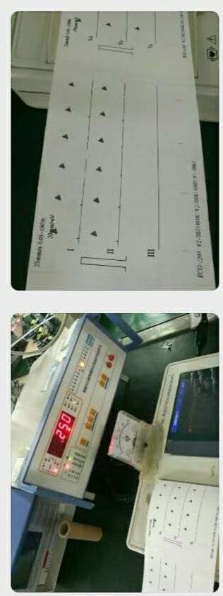  high quality 3 channel ecg machine for hospital  3