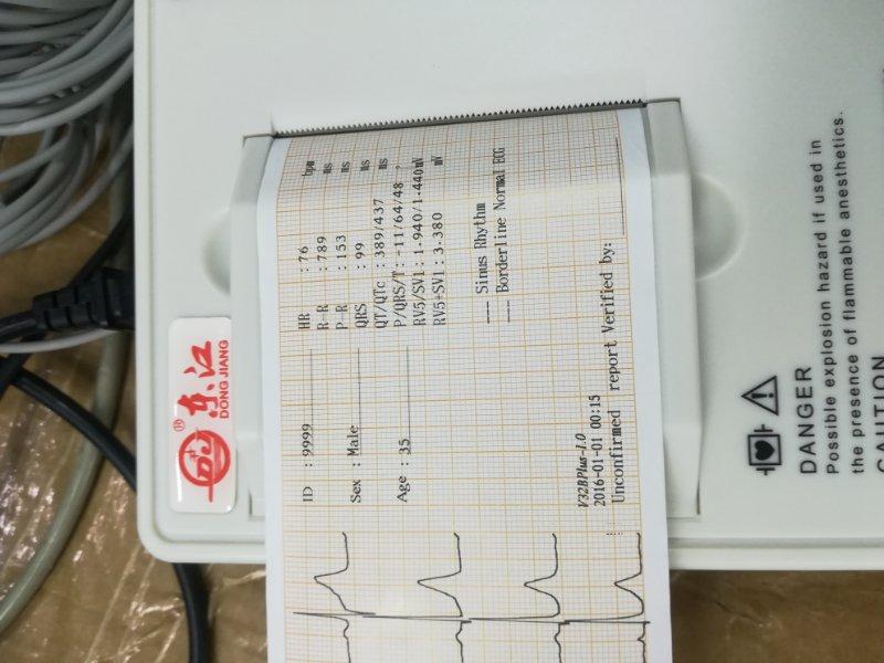  high quality 3 channel ecg machine for hospital  4