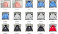kids moncler down jackets infants clothing outdoor jacket Spring clothing Summer