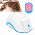 Portable Bald laser Head Hair Growth cold laser treatment helmet for home remedy 3