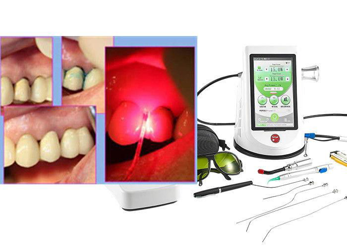 Dimed Dental Laser Machine Precise And Effective Way To Perform Dental Procedure 3