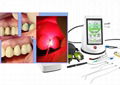 Dimed Dental Laser Machine Precise And Effective Way To Perform Dental Procedure 3