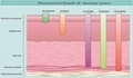 PERALAS Laser Therapy Machine Effectively Coagulate Small Blood Vessels To Treat 2