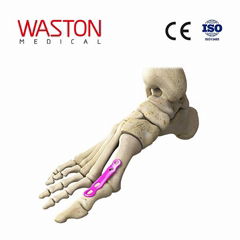 Implants Foot Orthoses Orthopaedics CE Metatarsophalangeal joint fusion plate II 