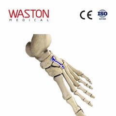 Implants Osteotomy CE The second metatarsal cuneiform joint dorsal plate 
