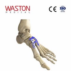 Implants Foot Orthoses Joints Osteotomy CE Lisfrance fusion plate 