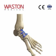 Implants Foot Orthoses Joints Osteotomy CE Muller Weiss plate 