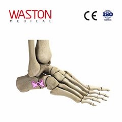Implants Foot Orthoses Joints Osteotomy CE Hollow calcaneus osteotomy plate 