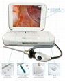 耳鼻喉內窺鏡  醫用攝像機