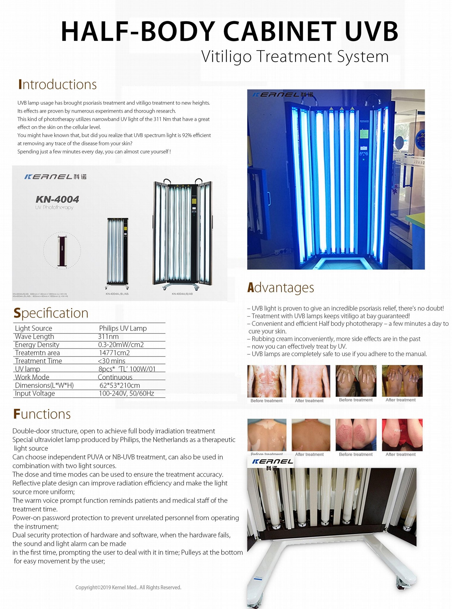 Hospital Use UV Phototherapy Dermatology Products Narrow Band UVB Lamps 4
