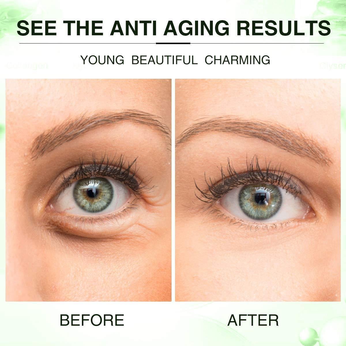 Private label green tea anti aging anti wrinkle eye treatment collagen eye patch 4