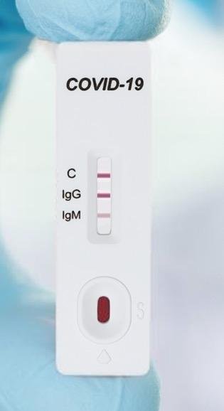 2019-nCoV IgM/IgG Antibody Test Kit (Colloidal Gold Method) 2