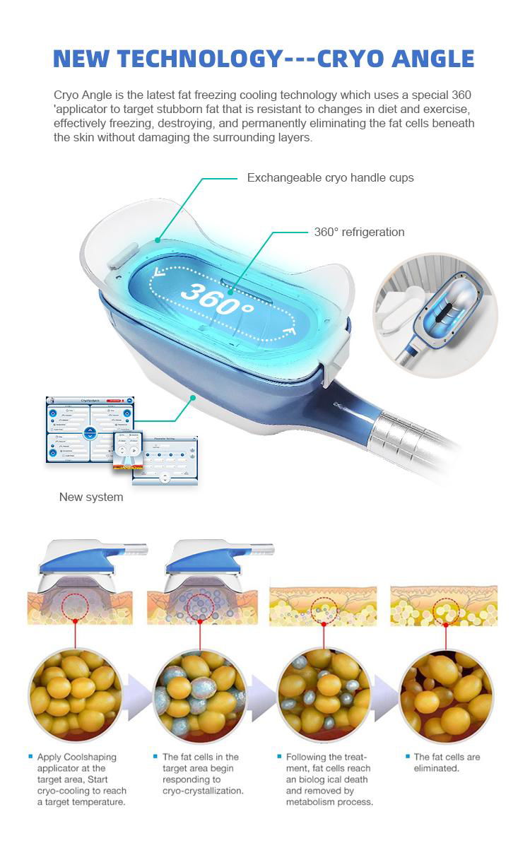 4 Cryo Handles 360 Angle Surrounding Cryo Slimming Machine 3