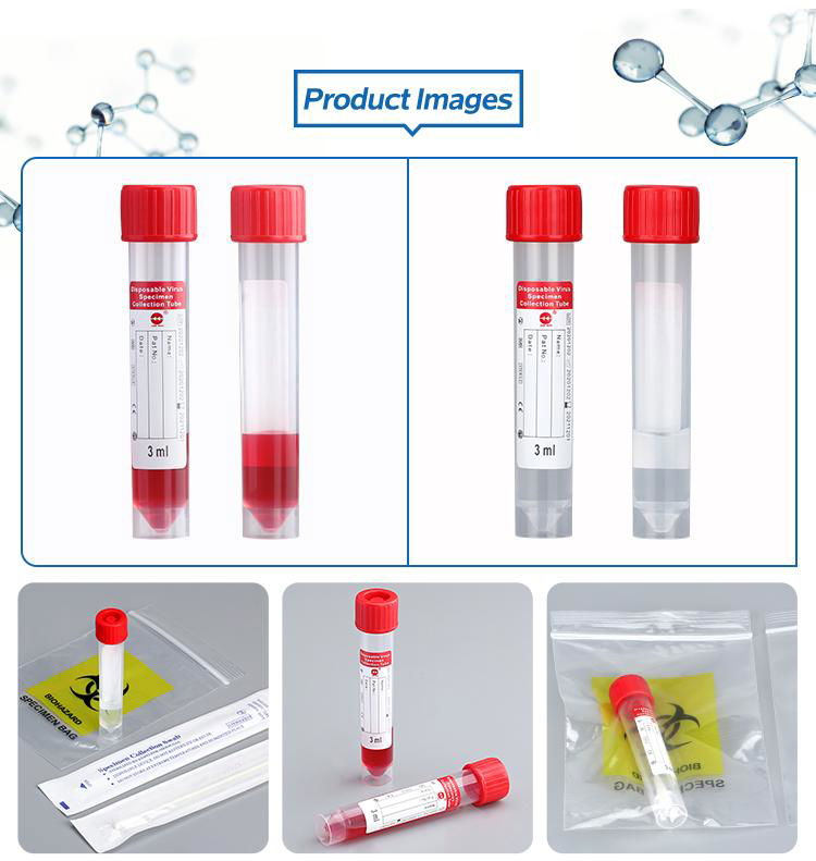 Factory supply Disposable VTM Transport Medium Swab PP specimen collection tube 4