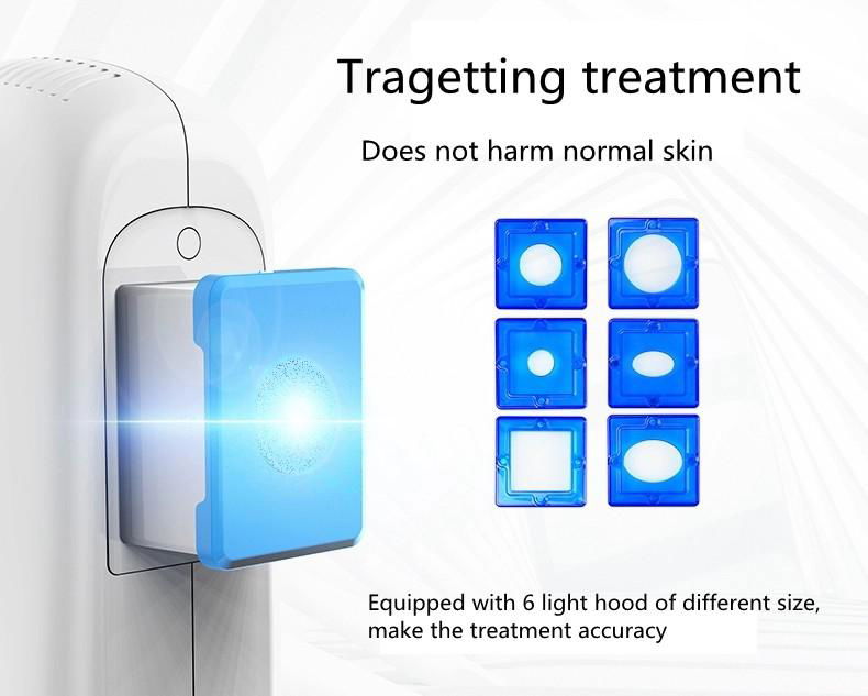 Portable EffectiveViiligo Psoriasis Eczema Kernel UVB Lamps Excimer laser UV Pho 4