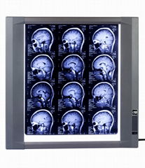 X-ray film viewer