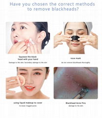 Blackhead Remover Tool