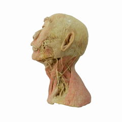 Human Head And Neck Plastinated Specimens