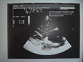 Ultrasound Paper Film/ UPP-110HD