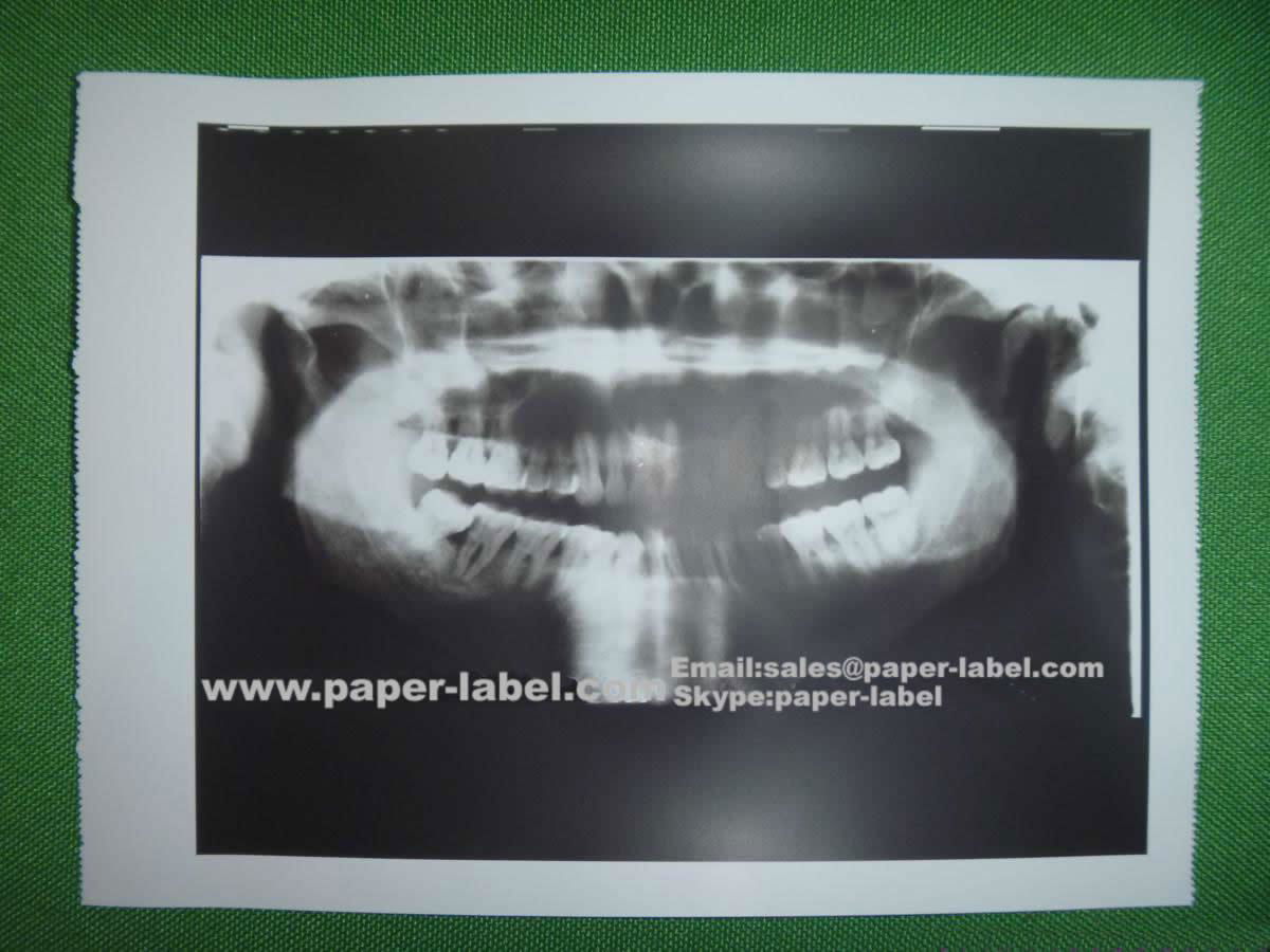 Ultrasound Paper Film/ UPP-110HD UPP-110S UPP-110HG KP61B-CE KP91HG substitute/M 3