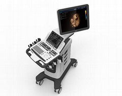 V60 Color Doppler Diagnostic Ultrasound System