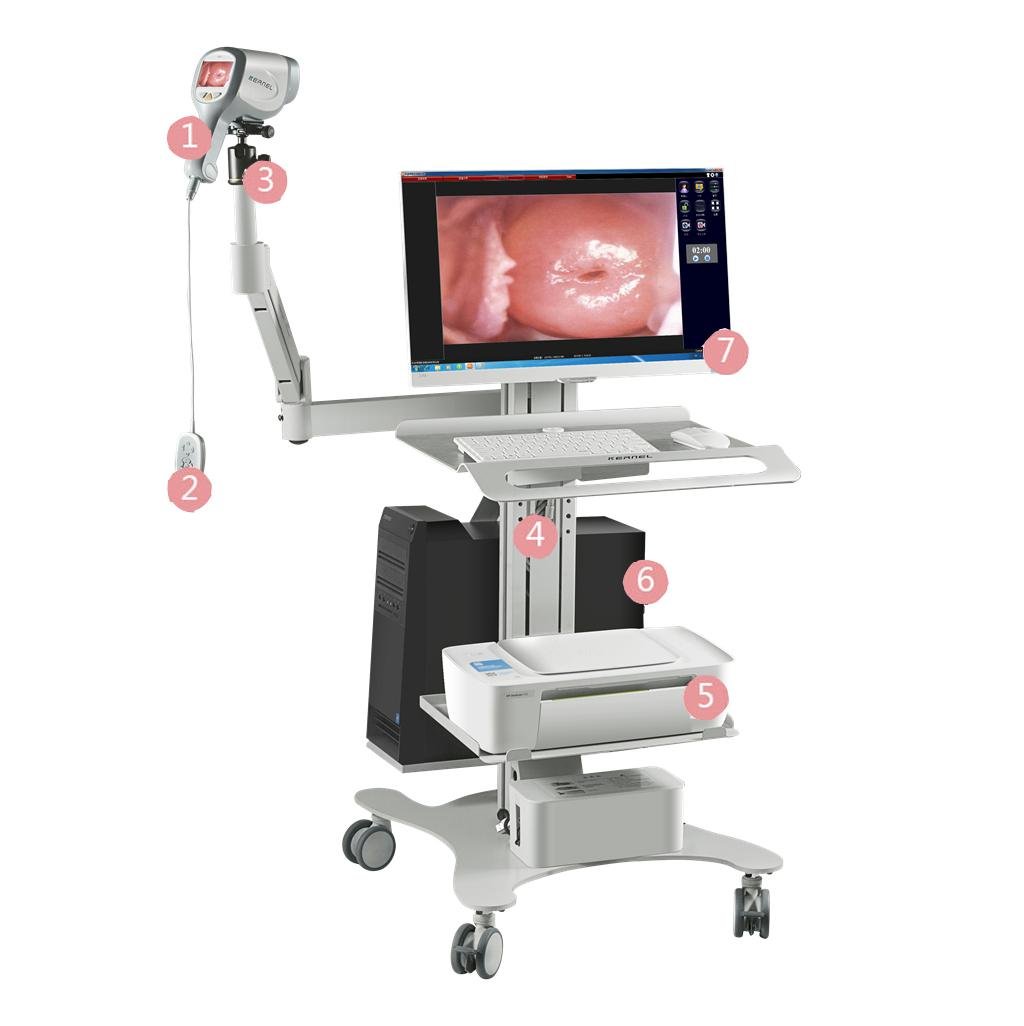Full HD Sony ccd digital camera video colposcope for gynecology examination 2