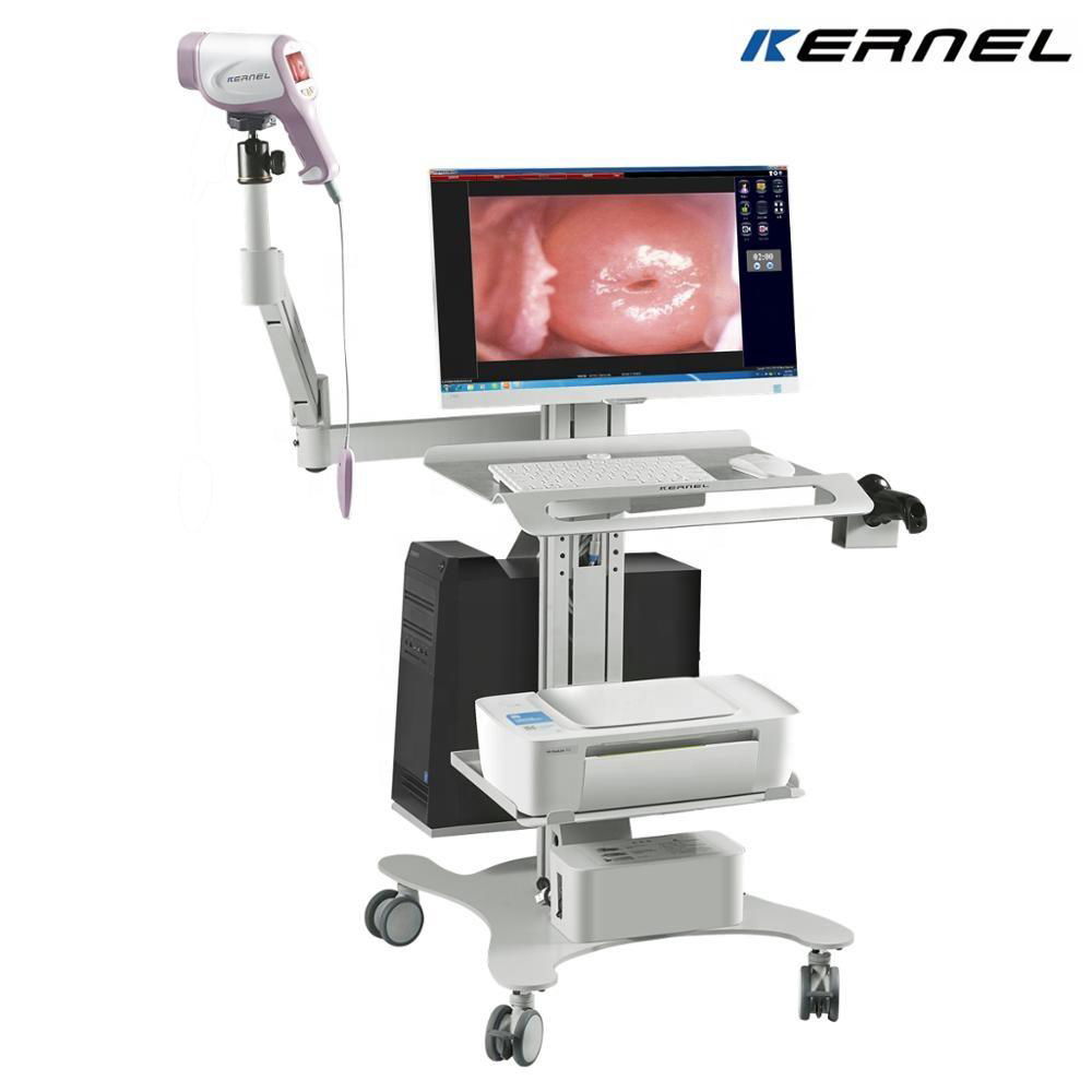 kernel Video Colposcope digital colposcopy gynecology endoscope price 2