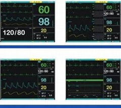 High Quality12.1 Inch Multi Parameter Patient Monitor