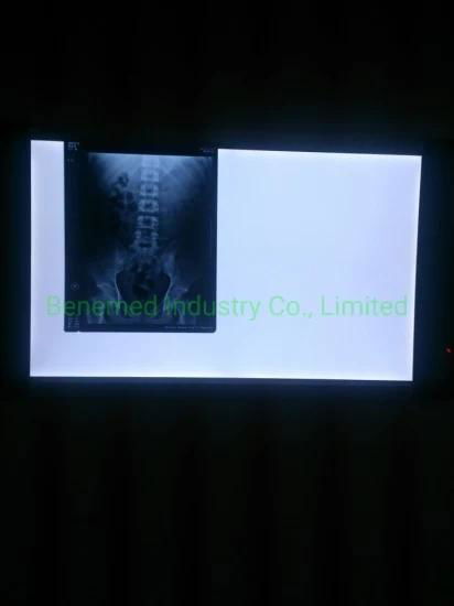Ultra Slim LED Medical X-ray Film Viewer Double Section  5