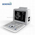 Portable B/W Ultrasound Scanner with Clear Image Quality 1