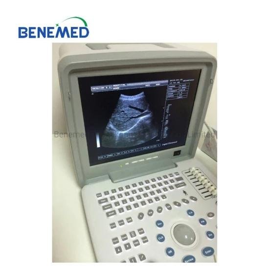 Portable B/W Ultrasound Scanner with Clear Image Quality 3