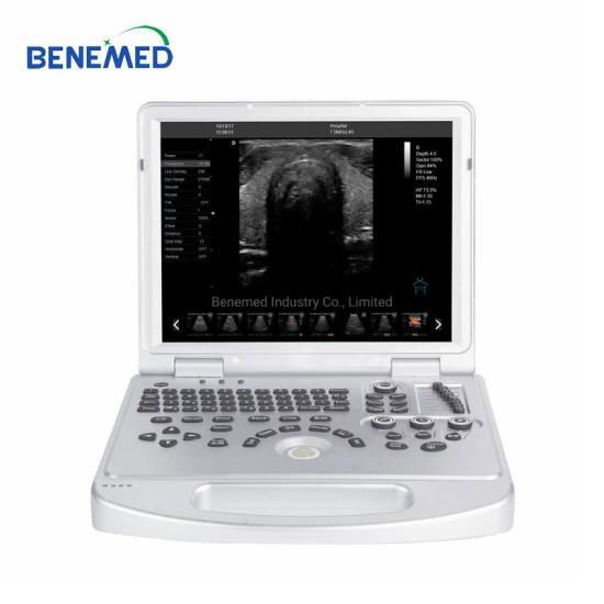 Laptop Notebook Ultrasound Scanner Color Doppler 3D 4D 5