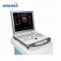 Laptop Notebook Ultrasound Scanner Color Doppler 3D 4D