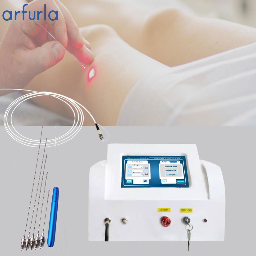 Arfurla 1470 980 nm Medical liposuction laser machine  plastic surgery fiber 1