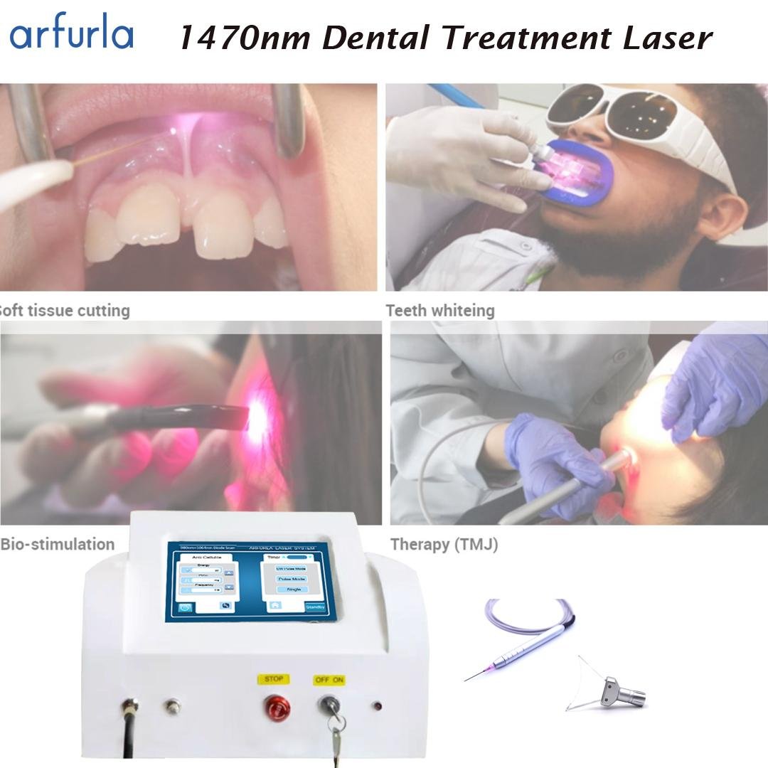 Arfurla 980nm 1470nm  for soft tissue wound treatment laser teeth whitening 