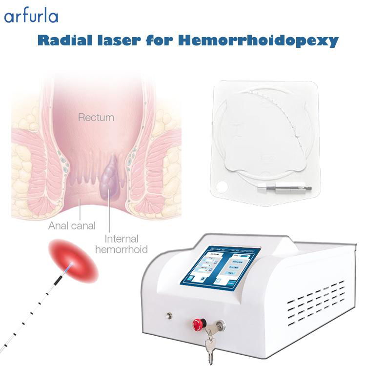 Arfurla hemorrhoids anal fistula PNS treatment laser machine