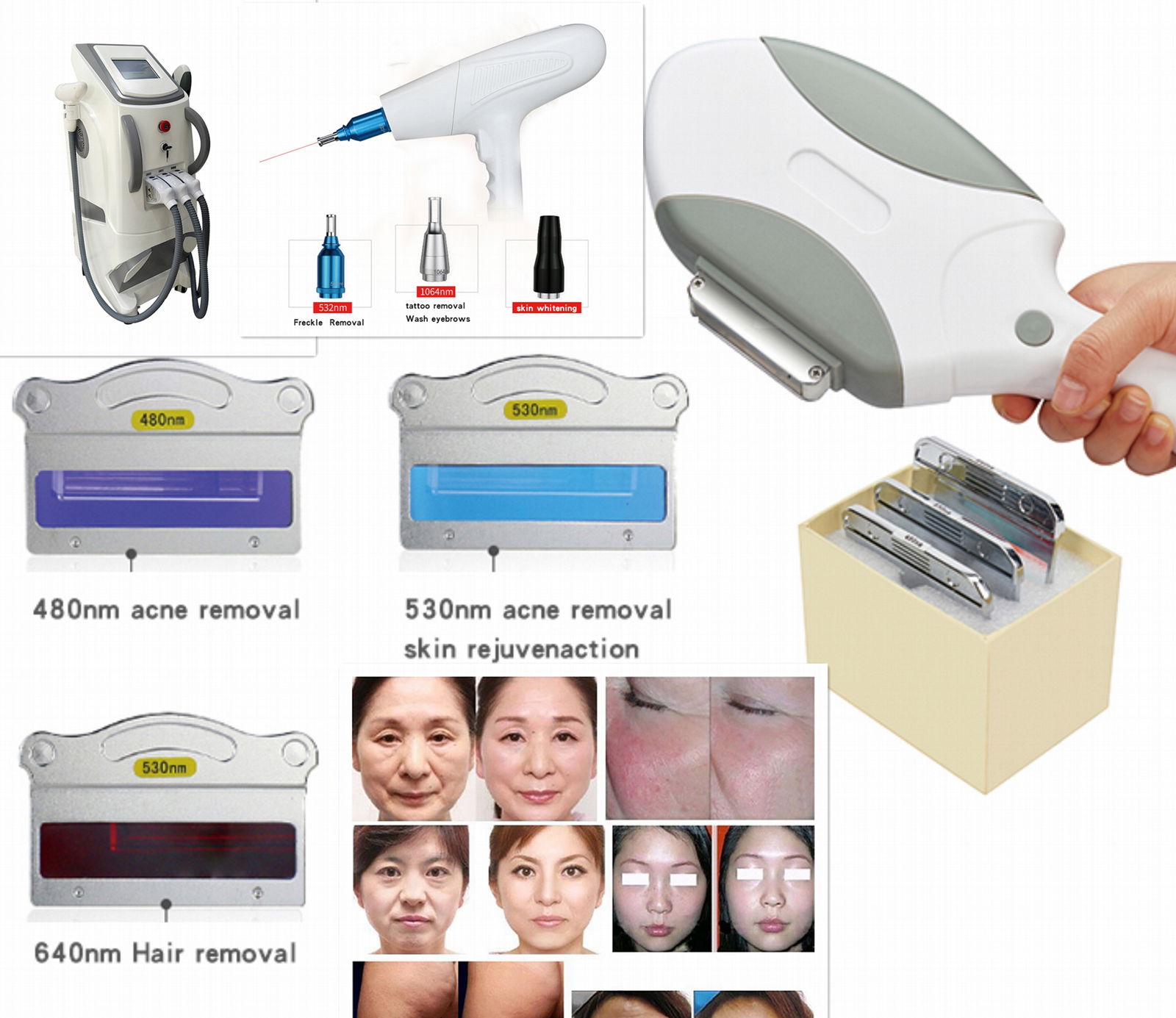 3 in 1 360 skin care Elight Shrrf nd yag IPL OPT Laser + RF Laser Hair Removal 4