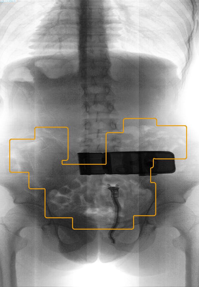 啟路達腹部檢測安檢機器人 2